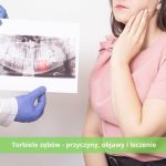 Torbiele zębów - przyczyny, objawy i leczenie