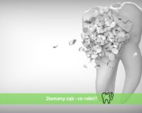 złamany ząb co robić